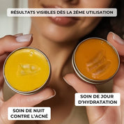 Rituel Complet Anti-Acné - Peau Nette & Confiance Retrouvée