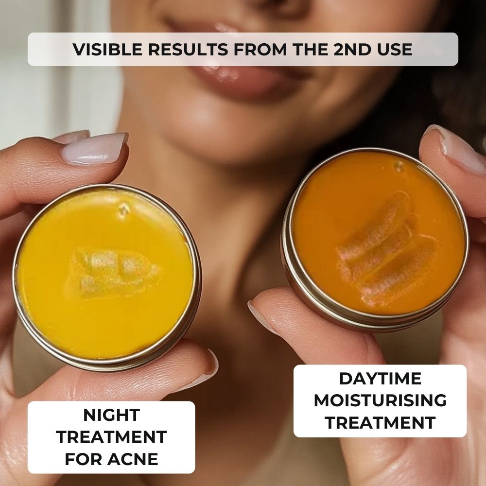 Complete Anti-Acne Ritual – Clear, Blemish-Free Skin