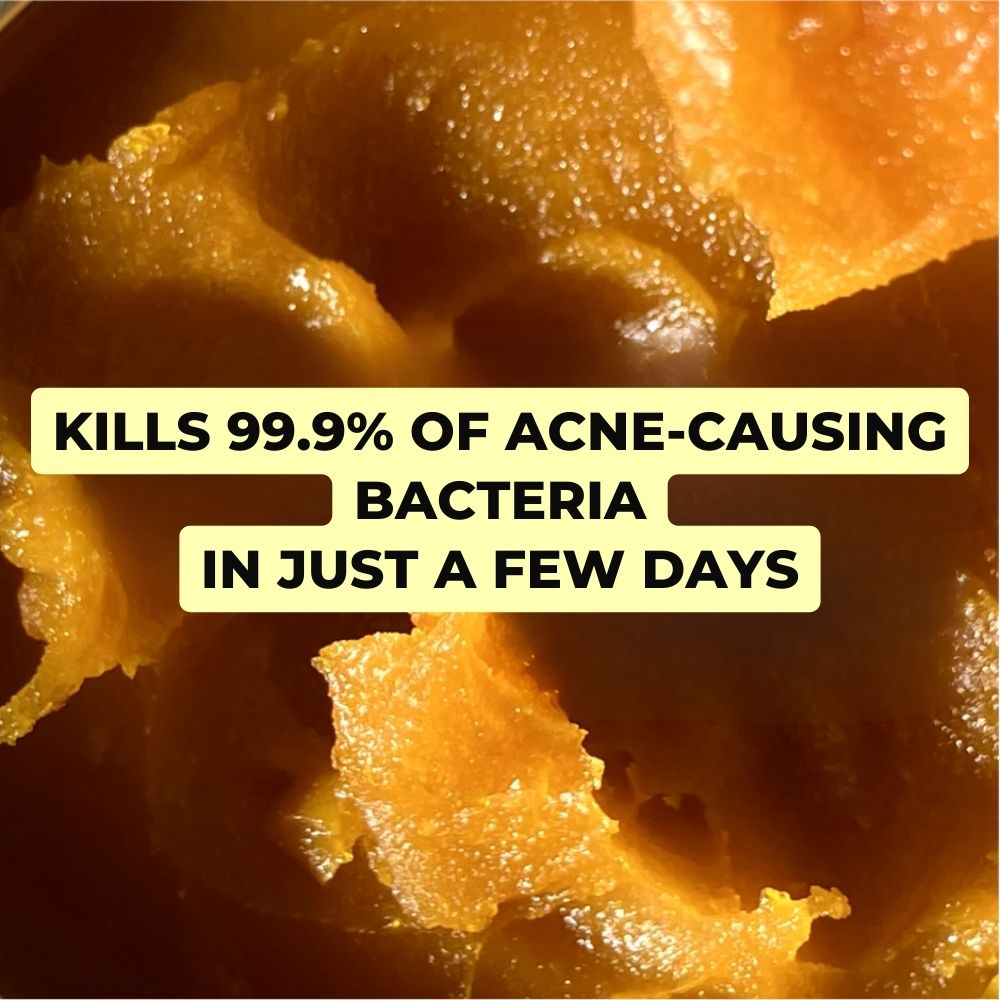 Complete Anti-Acne Ritual – Clear, Blemish-Free Skin